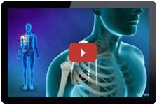 Patient Education Videos